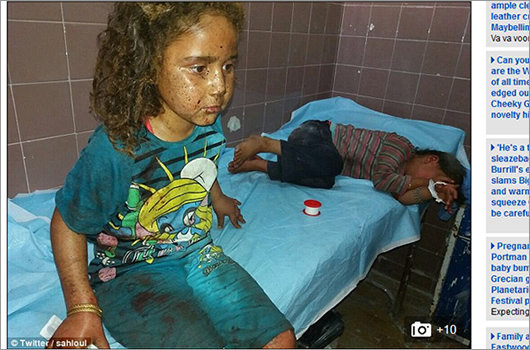 【閲覧注意】フェイスブックが削除した「ナパーム弾」写真、現在でも民間人25人が死亡。少年少女の肌は焼けただれる=シリアの画像2