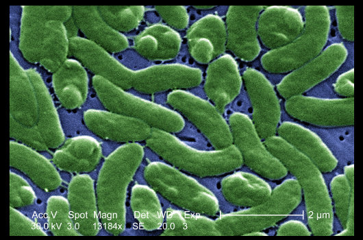 1703_flesheatingbacteria_1.jpg