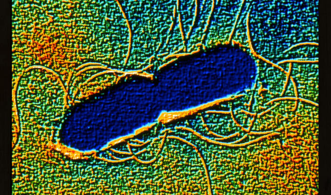 致死率95%超え、意識障害、皮膚突き破り…! 人間の目には見えない極小の殺人バクテリア5選!の画像4