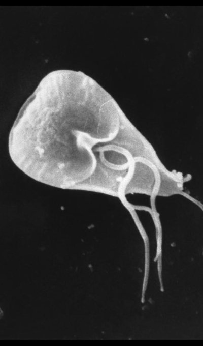 致死率95%超え、意識障害、皮膚突き破り…! 人間の目には見えない極小の殺人バクテリア5選!の画像5