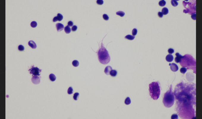 致死率95%超え、意識障害、皮膚突き破り…! 人間の目には見えない極小の殺人バクテリア5選!の画像6