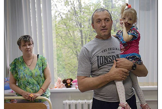 【閲覧注意・奇形】唇がくり抜かれた少女ダリア ー 口の中が剥き出しで生まれて =ロシアの画像3