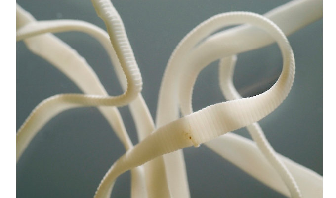 【閲覧注意】人間の体内から発見されたゾッとするほど身の毛もよだつ生命体5選! ウジ虫から種子まで!の画像5