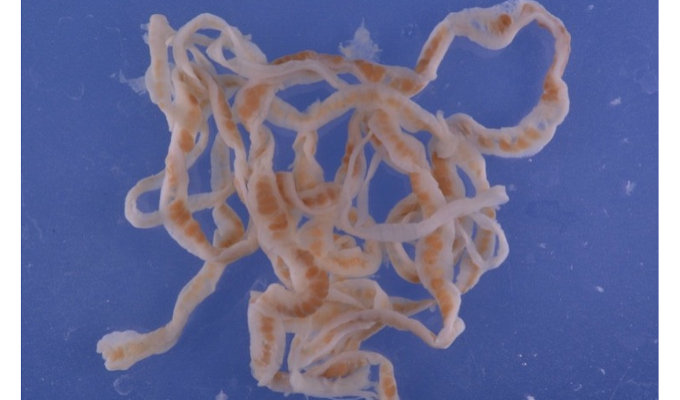 【閲覧注意】人間の体内から発見されたゾッとするほど身の毛もよだつ生命体5選! ウジ虫から種子まで!の画像6