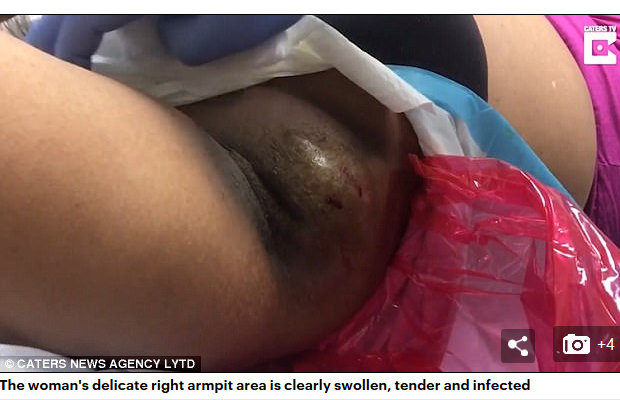 【閲覧注意】脇下からドバドバ流れまくる謎の大量液体に戦慄!女性の唸り声と最凶の悪臭…地獄の施術動画!=米の画像1