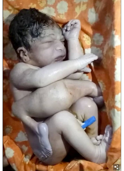 1708_twinbaby_2.jpg