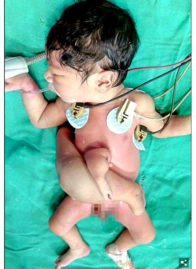1708_twinbaby_3.jpg