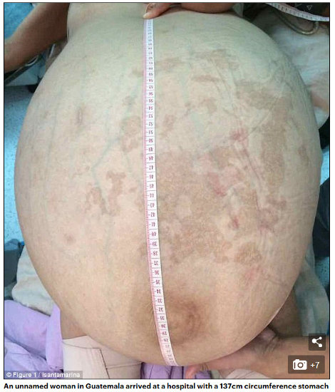 1708_womantumor_2.jpg