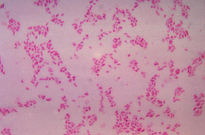 世界各地で報告される「最恐の病原菌」5選が絶望的すぎる! 肉体を壊死させ脳を侵食、治療も困難…!の画像5