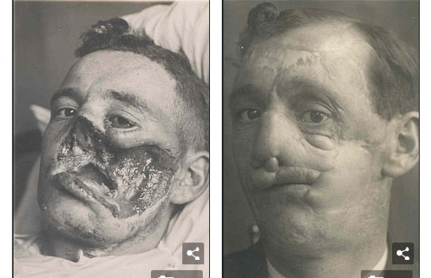 1710_horriblefacesurgery_2.jpg