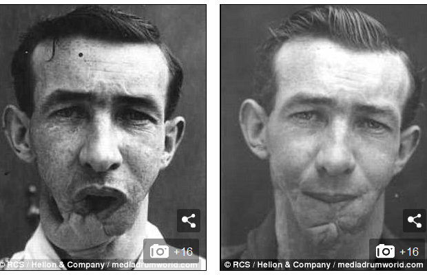 1710_horriblefacesurgery_3.jpg