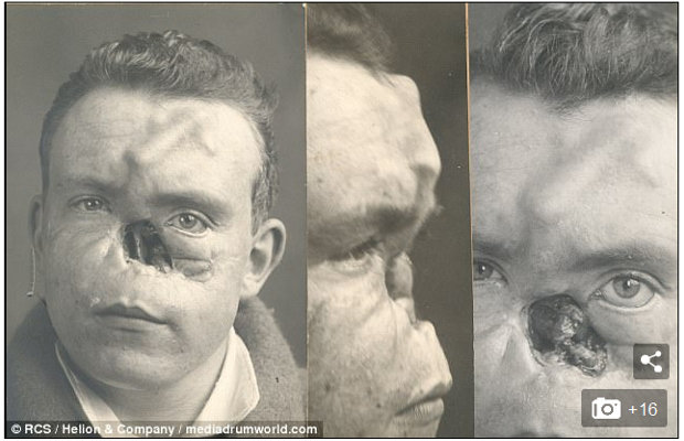 1710_horriblefacesurgery_6.jpg