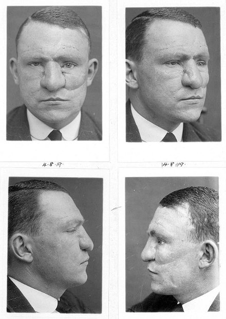 1710_horriblefacesurgery_7.jpg