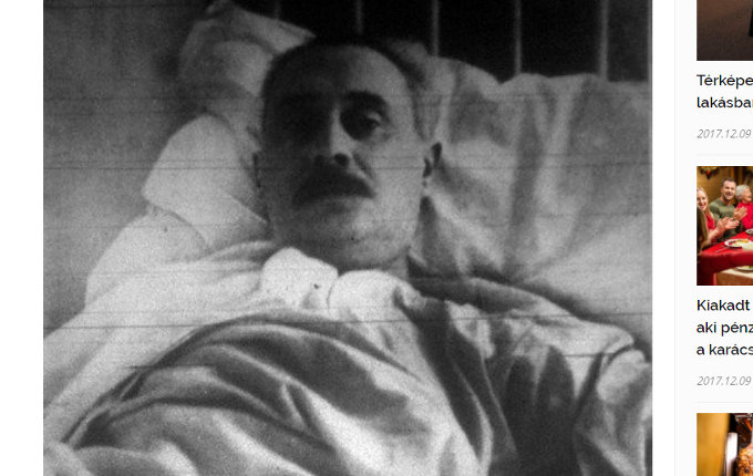 前頭葉を撃ち抜かれた男の不思議、30年以上頭に弾が入ったままの男…頭を撃たれても生き残った人々5選!の画像4