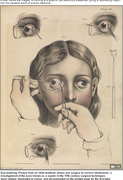 19thcenturysurgery1.JPG