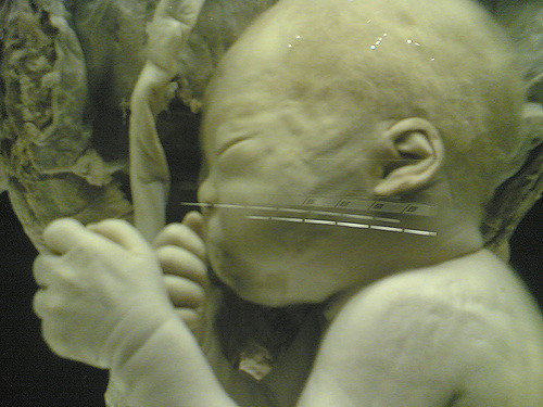 【閲覧注意】病院で奇形胎児の残酷すぎる品評会が開催されていた！ 緑色の肌、ねじれボディ、粘土細工のような胎児も…！の画像1