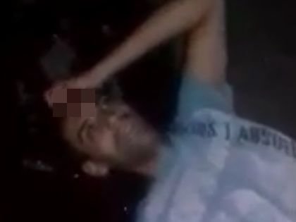 【閲覧注意】頭を撃ち抜かれた男が奇跡の蘇生、フラフラ歩き始める衝撃ガチ映像! 血塗れの頭を撫でながら、戦慄の表情を浮かべ…!の画像1