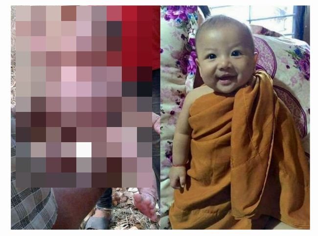 【閲覧注意】鬼畜母にナイフで14回刺され、生き埋めにされた赤ん坊! 驚異的生命力で奇跡の回復を遂げる=タイの画像1