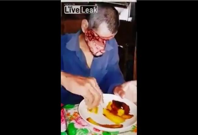 【閲覧注意】顔がない男の食事風景に感動する! 顔面崩壊しても人間らしく生きる者たちの勇姿を見よ!の画像2