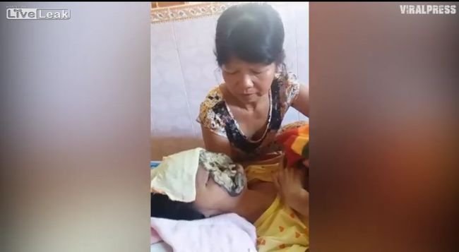 【閲覧注意】顔がない男の食事風景に感動する! 顔面崩壊しても人間らしく生きる者たちの勇姿を見よ!の画像6