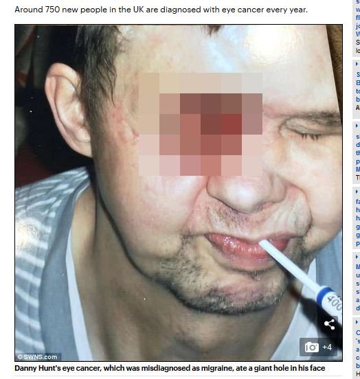 【閲覧注意】手術で顔面に大穴が空いた男! 恐ろしい姿に絶叫する孫娘、穴から流れる体液… 良きパパを襲った地獄の苦しみとは?の画像1