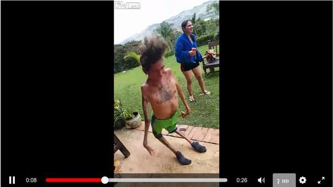 【閲覧注意】レイブパーティーで踊り狂う奇形男性が超絶カッコいい！ 逆関節をもつ「反張膝」の人々が話題＝ブラジルの画像1