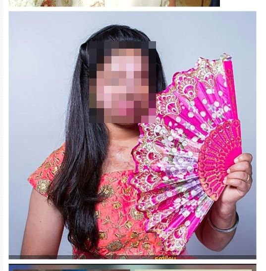 【アシッドアタック閲覧注意】15歳美少女が目鼻口を失い顔面崩壊! 初老男からの求婚拒否で…「生きる希望失った」=印の画像1