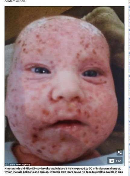 20180817_baby_02.jpg