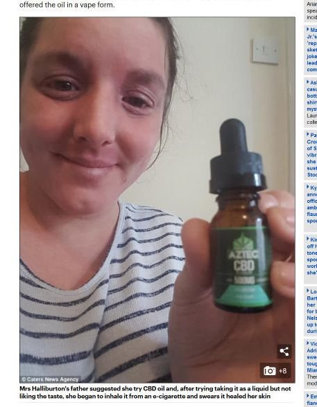 【閲覧注意】「CBD大麻オイル」をVAPEで吸引したら重度の湿疹肌が改善、海外で話題! 赤く腫れた顔がスッキリ=スコットランドの画像6