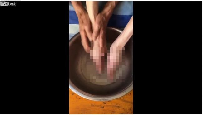 【閲覧注意】纏足の老婆が足を洗う光景が悲しすぎる! 足がクチバシのように… 女性を苦しめた文化の実態の画像1