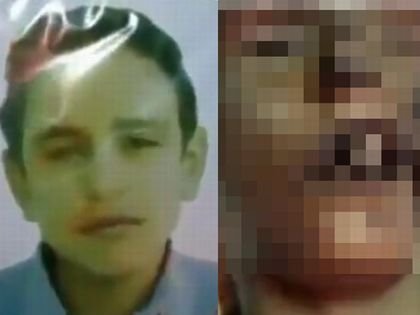 閲覧注意 アサド政権が15歳中学生を拷問 死体が痛ましすぎて絶句 頬に穴 体を棒が貫通 許せぬ 身体破壊拷問 シリア