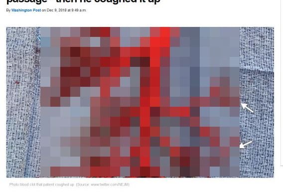 20181220_blood_01.jpg