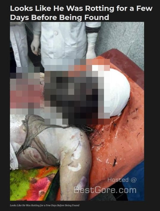 【超・閲覧注意】アシッドアタックで死んだ男の変容がとてつもなくヤバい! 苦悶の表情さえ真っ黒に溶け…=インドの画像1