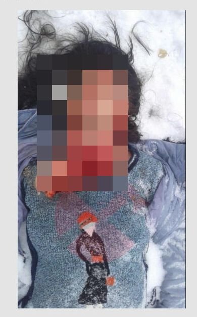 【超・閲覧注意】滑って転倒 → 動けず凍死 → 野生動物に喰われた女が悲惨すぎる!恐ろしい顔面に震える!=ロシアの画像3