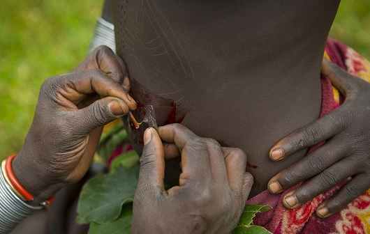 「針とカミソリで肌に模様を刻む」！　アフリカの部族に伝わる風習、スカリフィケーションの実態とは!?の画像2
