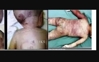 【閲覧注意】米史上最悪「悪魔のような幼児虐待事件」全貌! 膣・肛門を指で裂き腸破裂、全力放り投げ… 鬼畜夫婦!の画像2