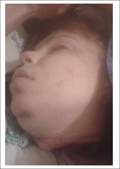 【閲覧注意・速報】ロシア「人肉食夫婦」事件全貌&モロ画像! 冷蔵庫の人肉片、死体の塩漬け、生首オードブル… 史上最悪のカニバリズム地獄の画像7