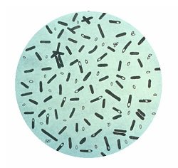 たった500gで人類を滅亡させる猛毒「ボツリヌス」が潜む食品とは? ボトックス整形は顔が固まる例も【ググっても出ない毒薬の手帳】の画像1