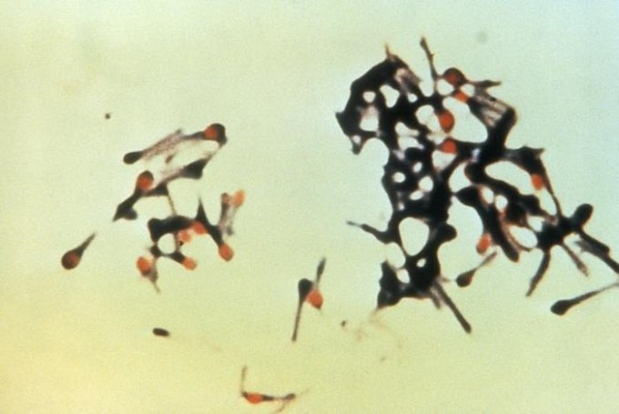 たった0.0000001グラムで逝く!! 地球最凶の毒素「テタヌストキシン」で死ぬ日本人が急増のなぜ【ググっても出ない毒薬の手帳】の画像1
