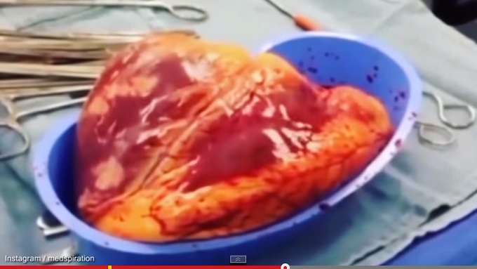 CocaineAndHeartHealth.jpg