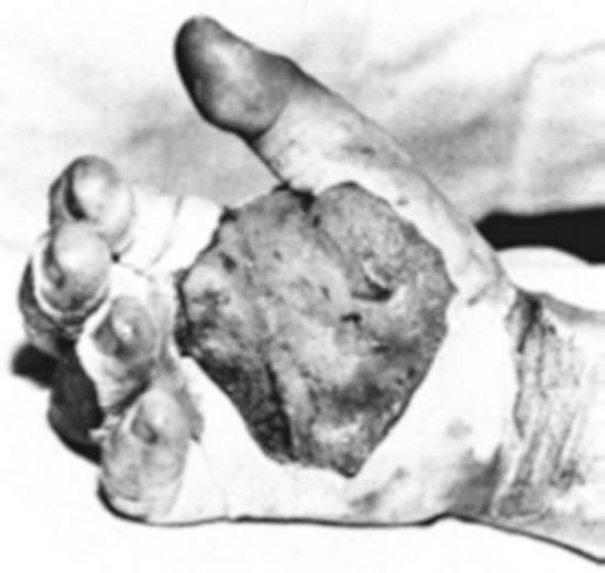Daghlians-Hand.jpg