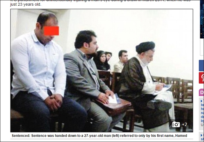 「目玉くり抜き」「両手切断」……増加するイランの報復刑!! 人権無視の壮絶司法!の画像1