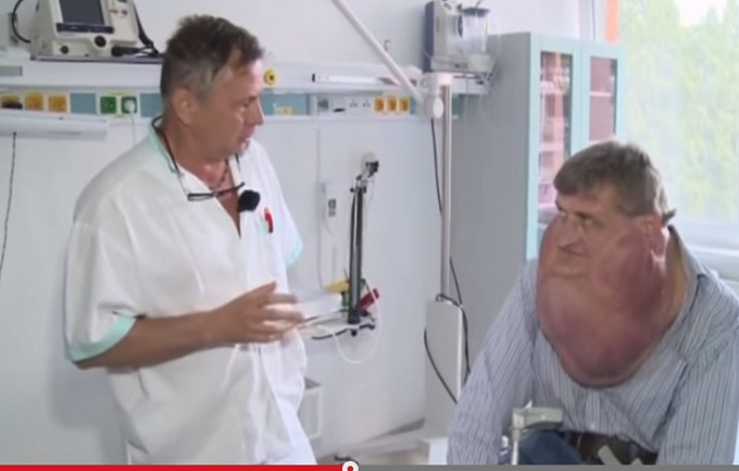 GiantTumour.jpg