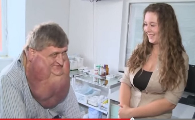GiantTumour_3.jpg
