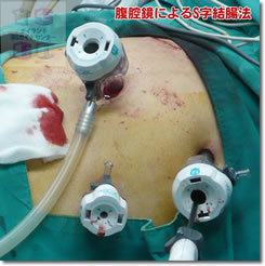 【やや閲覧注意】実録!タイの性器事情 ニューハーフになるためのすべての画像4