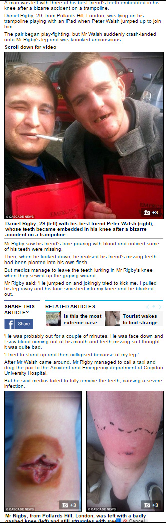 Man-left-with-friend-s-teeth-embedded-inside-his-KNEE-after-bizarre-trampoline-accident---Daily-Mail-Online.jpg