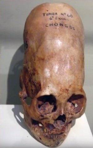 宇宙人疑惑「パラカスの頭蓋骨」2回目のDNA解析結果が公開される！ 人類史を塗り替える新事実が発覚？の画像2