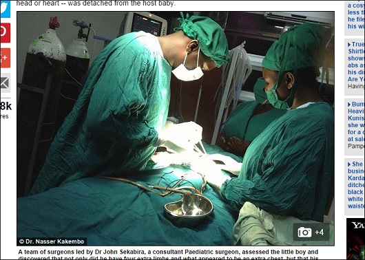 ParasiticTwin_2.jpg