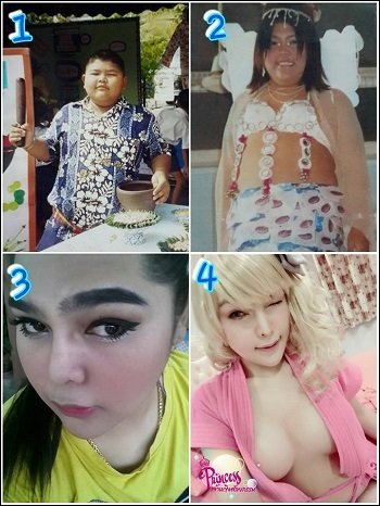 スーパーデブ男が超絶美女に大変身! 整形天国タイの実態がヤバすぎるの画像2