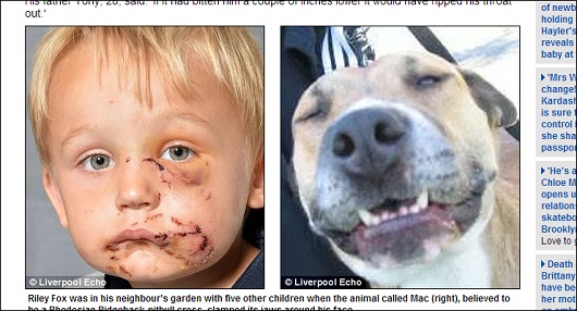 暑さでイラついたピットブル犬、4歳男児の頬を切り裂く!の画像1